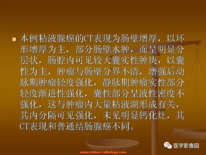 【病例】结肠粘液腺癌1例CT影像表现