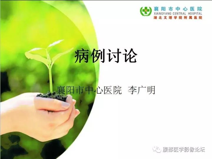 【病例】盆腔恶性血管周细胞瘤(外皮细胞瘤)1例