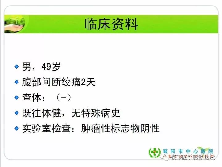 【病例】盆腔恶性血管周细胞瘤(外皮细胞瘤)1例