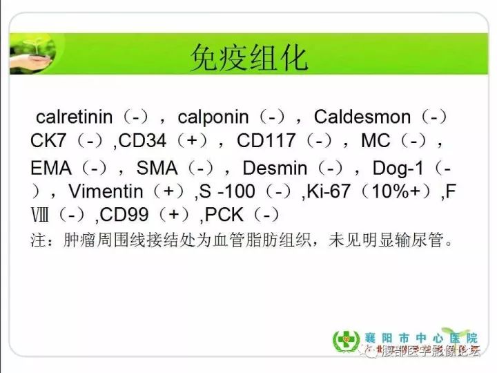 【病例】盆腔恶性血管周细胞瘤(外皮细胞瘤)1例