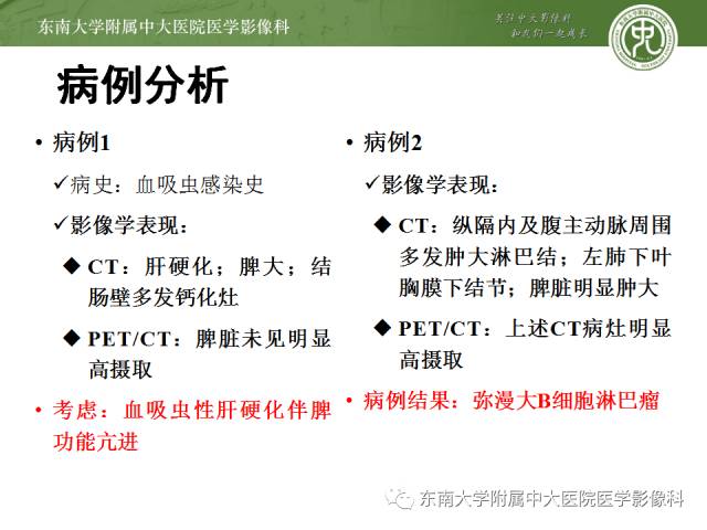 【病例】脾脏肿大两例PET/CT影像诊断与鉴别