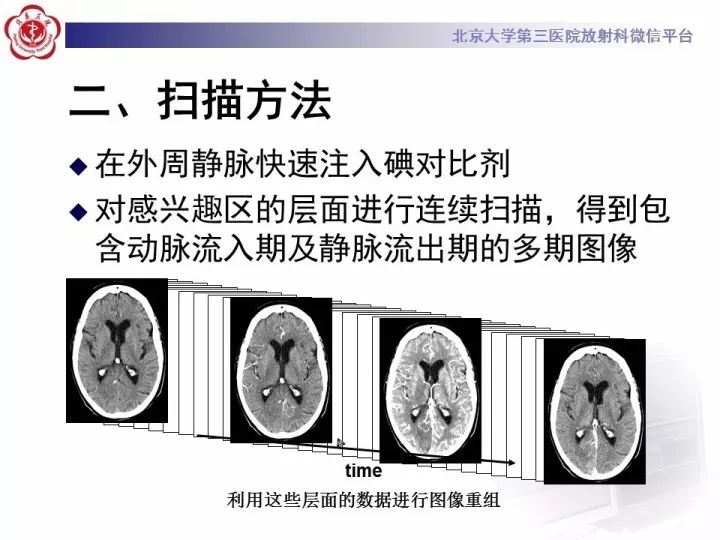 【PPT】脑CT灌注成像