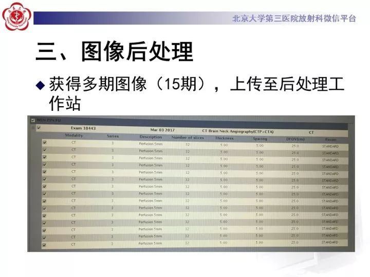 【PPT】脑CT灌注成像