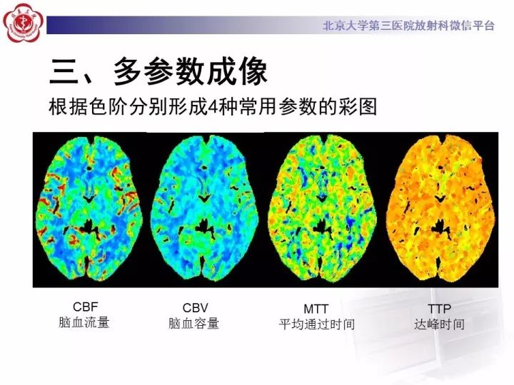 【PPT】脑CT灌注成像