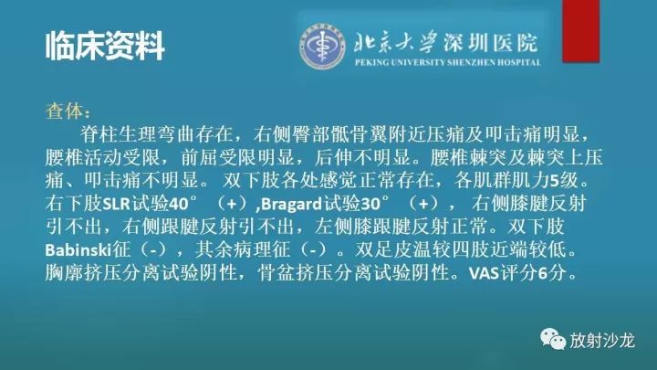 【病例】骶骨原始神经外胚层肿瘤1例CT及MR