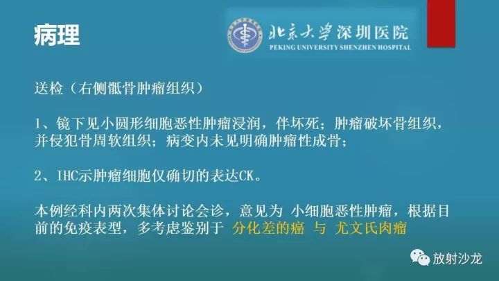 【病例】骶骨原始神经外胚层肿瘤1例CT及MR