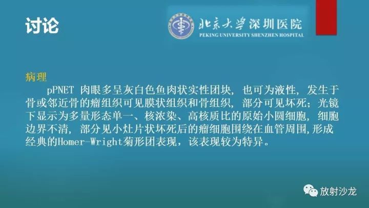【病例】骶骨原始神经外胚层肿瘤1例CT及MR