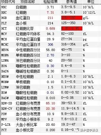 【病例】肺动脉静脉畸形1例CT 【病例】肺动脉静脉畸形1例CT