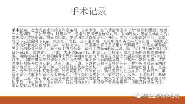 【病例】鞍旁分泌型脑膜瘤1例CT及MR