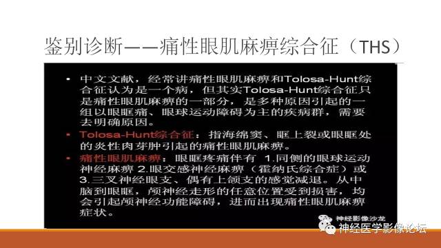 【病例】鞍旁分泌型脑膜瘤1例CT及MR