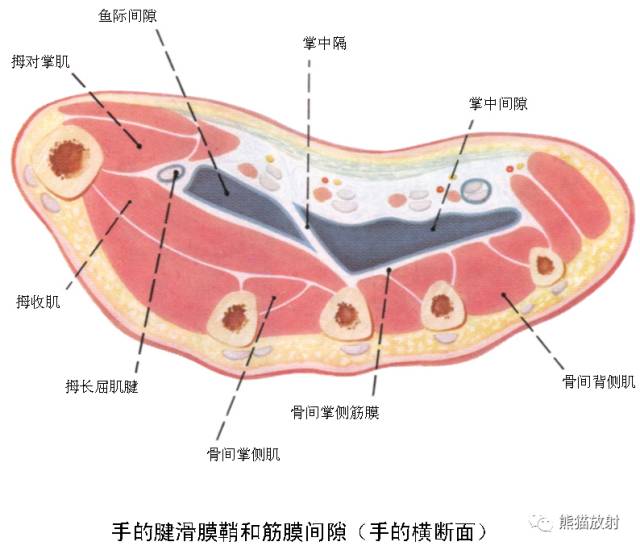 腕关节系统解剖图+冠状MRI 腕关节系统解剖图+冠状MRI