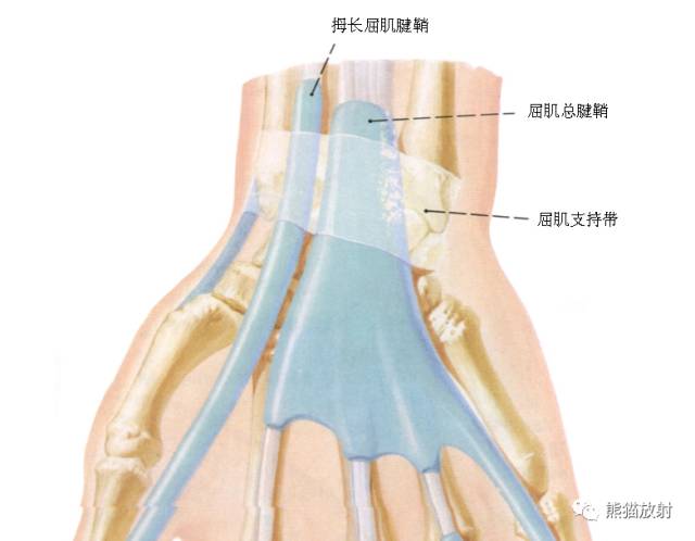 腕关节系统解剖图+冠状MRI 腕关节系统解剖图+冠状MRI