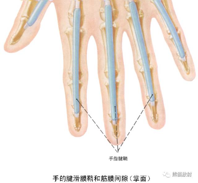 腕关节系统解剖图+冠状MRI 腕关节系统解剖图+冠状MRI