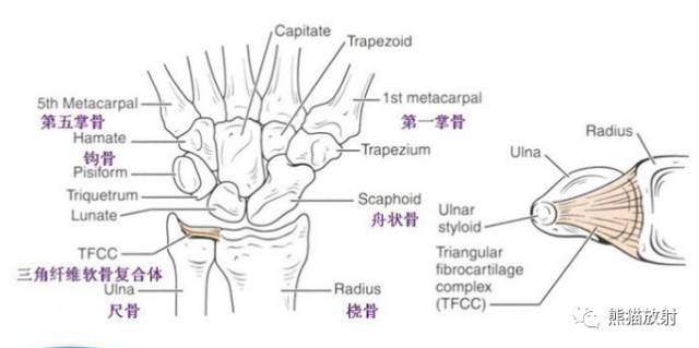 腕关节系统解剖图+冠状MRI 腕关节系统解剖图+冠状MRI
