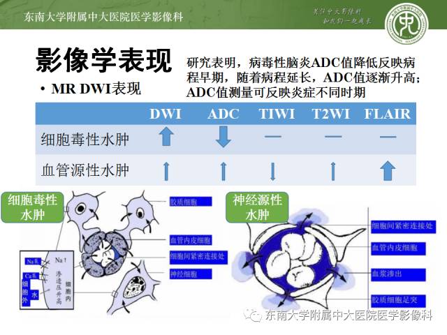【病例】单纯疱疹型病毒性脑炎1例MR 【病例】单纯疱疹型病毒性脑炎1例MR