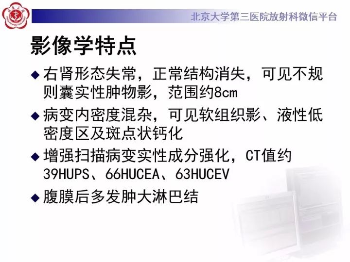 【病例】右肾乳头状肾细胞癌1例CT影像表现