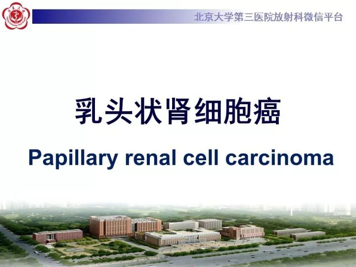 【病例】右肾乳头状肾细胞癌1例CT影像表现