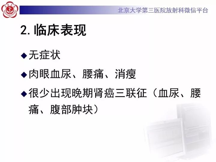 【病例】右肾乳头状肾细胞癌1例CT影像表现