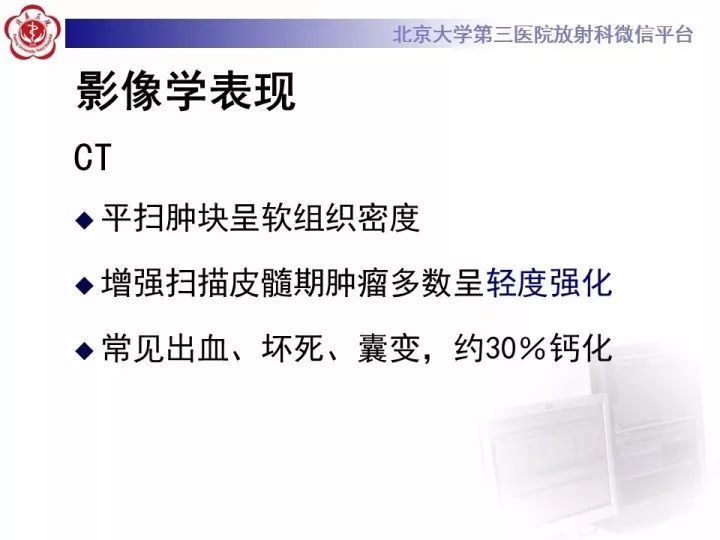 【病例】右肾乳头状肾细胞癌1例CT影像表现