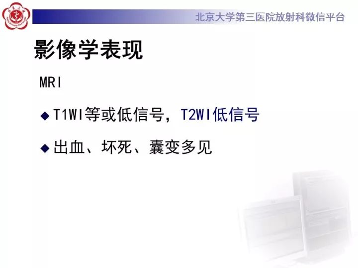 【病例】右肾乳头状肾细胞癌1例CT影像表现