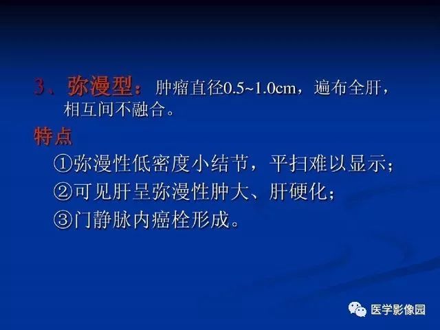 【PPT】原发性肝癌的CT技术和诊断指南