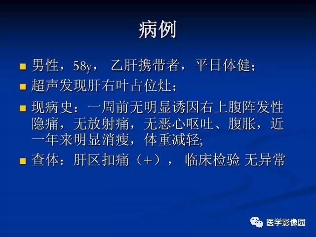 【PPT】原发性肝癌的CT技术和诊断指南