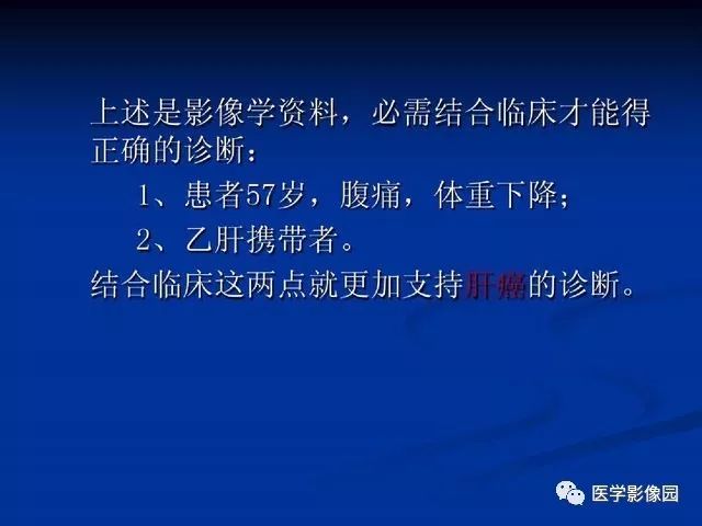 【PPT】原发性肝癌的CT技术和诊断指南