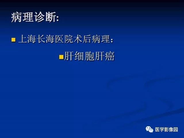 【PPT】原发性肝癌的CT技术和诊断指南