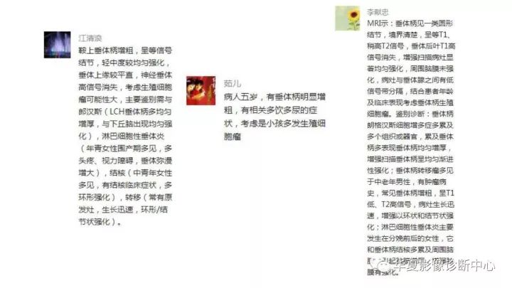 【病例】垂体柄升值细胞瘤1例MR