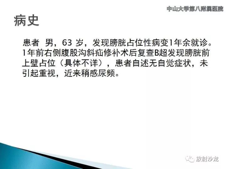 【病例】膀胱淋巴瘤1例CT影像表现