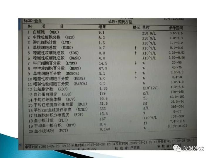 【病例】膀胱淋巴瘤1例CT影像表现