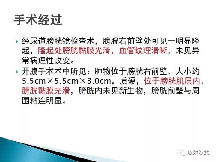 【病例】膀胱淋巴瘤1例CT影像表现