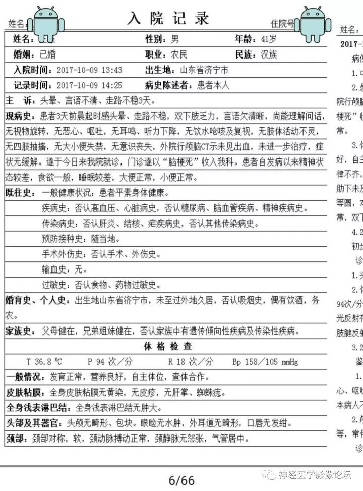 【病例】不多见苯中毒脑病一例MR 【病例】不多见苯中毒脑病一例MR