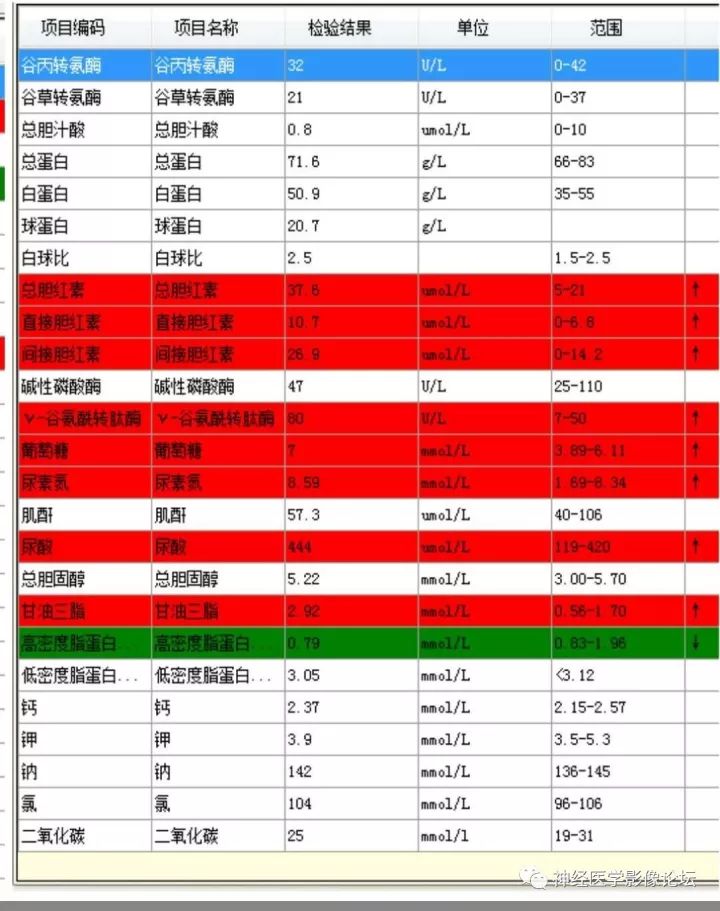 【病例】不多见苯中毒脑病一例MR 【病例】不多见苯中毒脑病一例MR