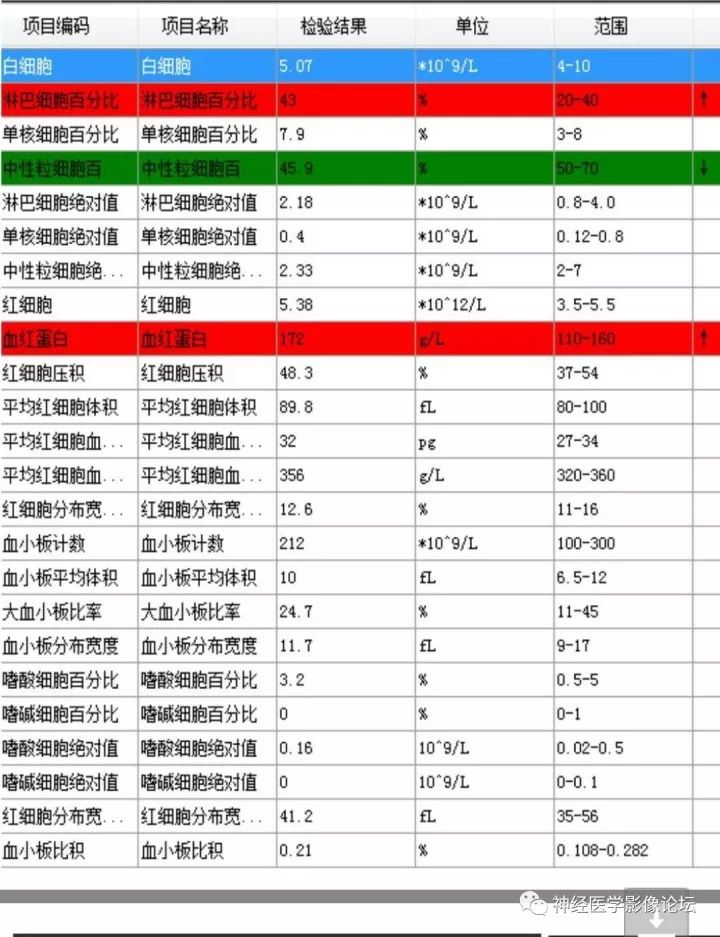 【病例】不多见苯中毒脑病一例MR 【病例】不多见苯中毒脑病一例MR