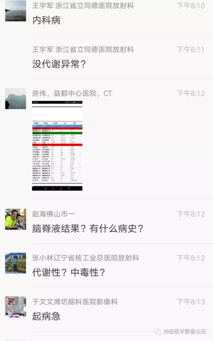 【病例】不多见苯中毒脑病一例MR 【病例】不多见苯中毒脑病一例MR