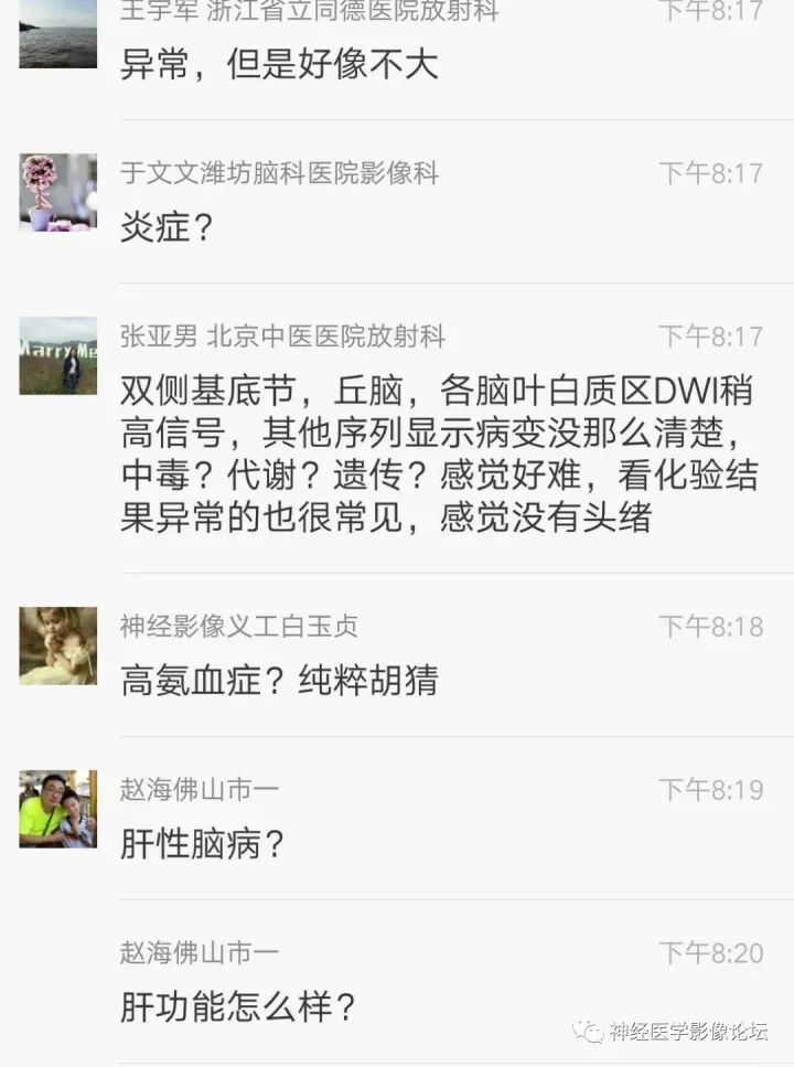 【病例】不多见苯中毒脑病一例MR 【病例】不多见苯中毒脑病一例MR