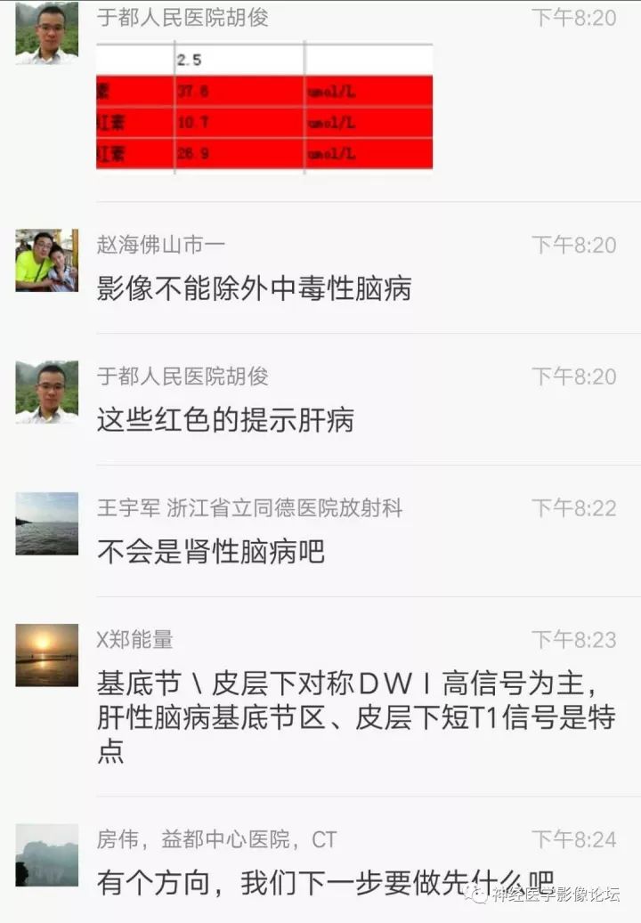 【病例】不多见苯中毒脑病一例MR 【病例】不多见苯中毒脑病一例MR