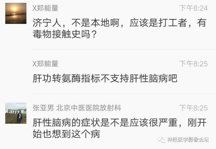 【病例】不多见苯中毒脑病一例MR 【病例】不多见苯中毒脑病一例MR