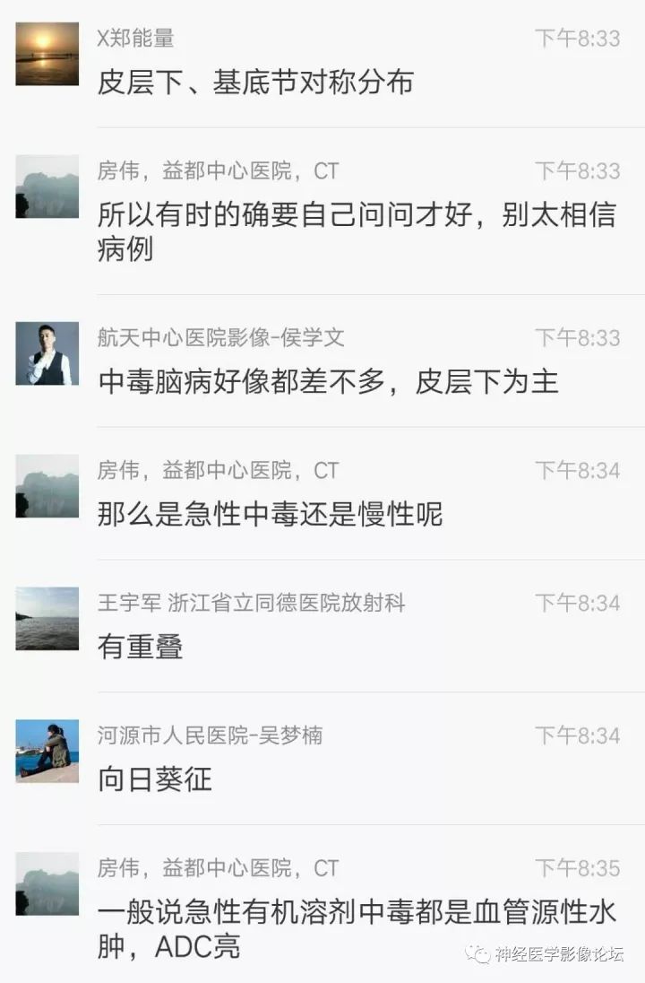 【病例】不多见苯中毒脑病一例MR 【病例】不多见苯中毒脑病一例MR