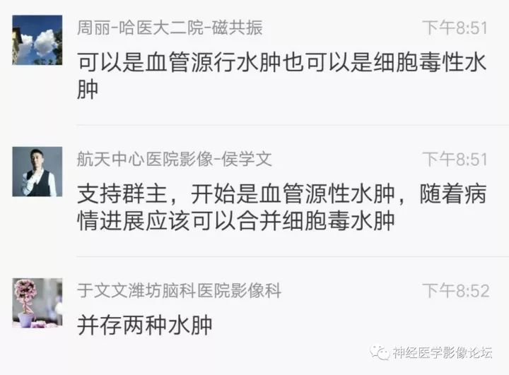 【病例】不多见苯中毒脑病一例MR 【病例】不多见苯中毒脑病一例MR