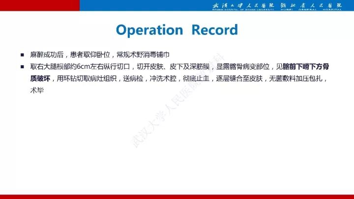 【病例】髂骨浆细胞性骨髓瘤1例MR影像诊断