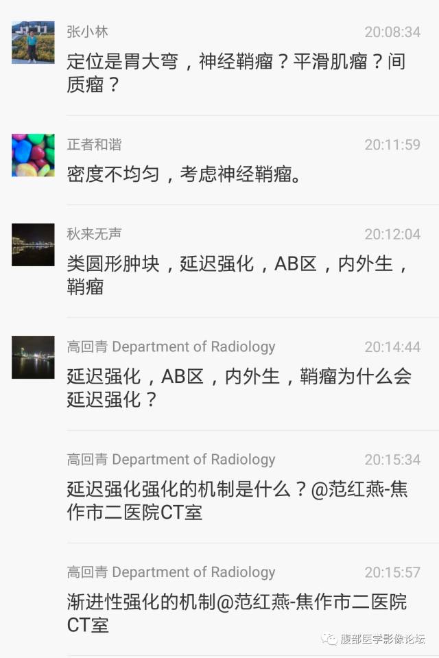 【病例】胃壁粘膜下占位3例CT影像表现