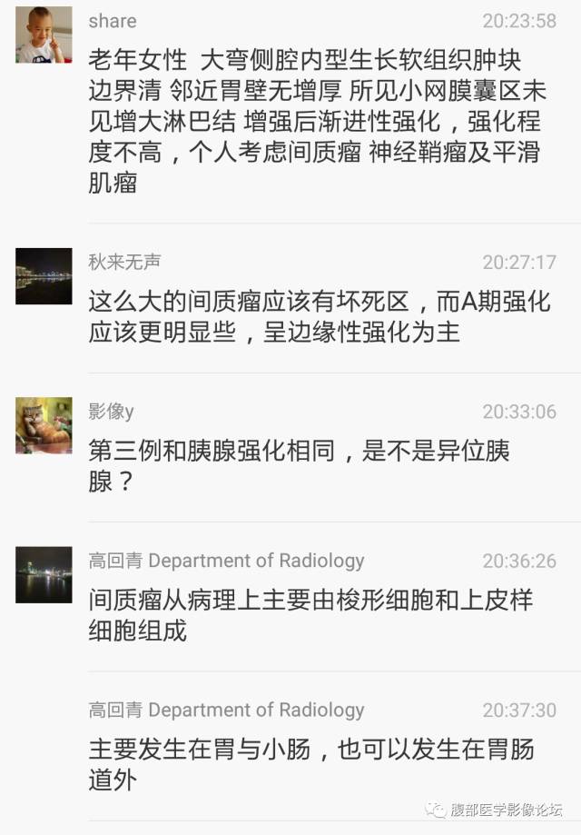 【病例】胃壁粘膜下占位3例CT影像表现