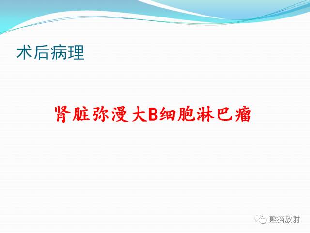 【病例】原发性肾淋巴瘤1例CT影像表现