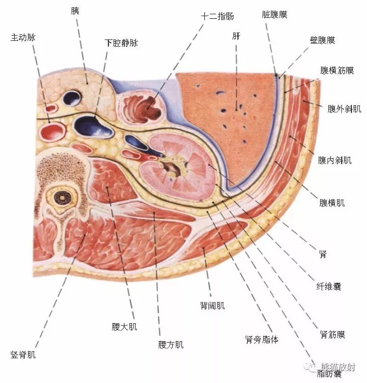 【病例】原发性肾淋巴瘤1例CT影像表现