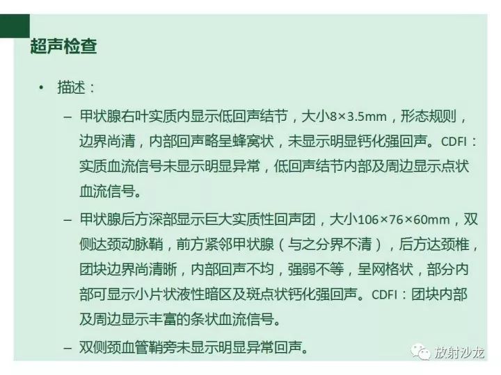 【病例】甲状腺恶性淋巴瘤1例CT影像表现