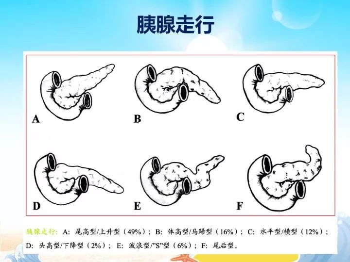 【PPT】胰腺肿瘤的影像诊断