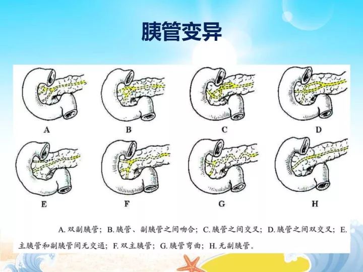 【PPT】胰腺肿瘤的影像诊断