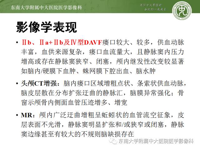 【病例】硬脑膜动静脉瘘1例MR影像诊断